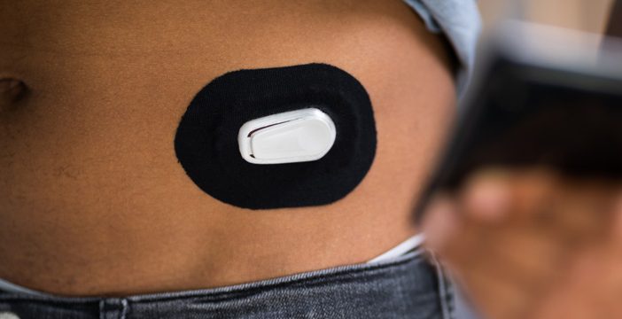 glucose sensor