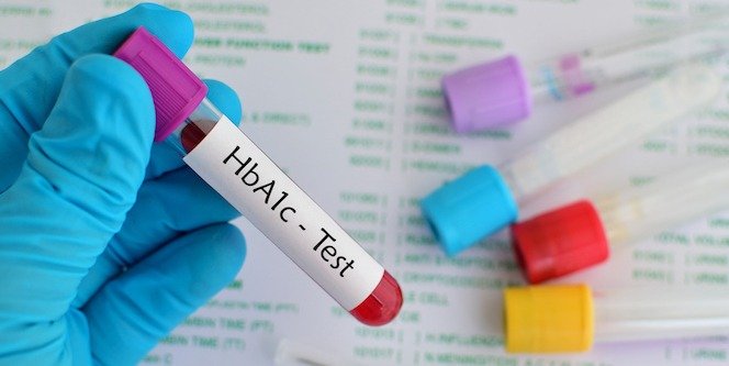 what is an a1c