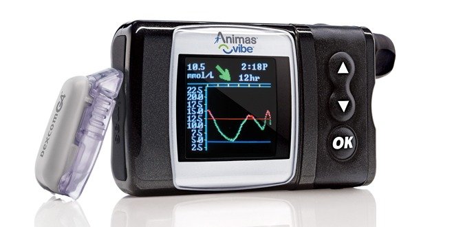 insulin pump and CGM