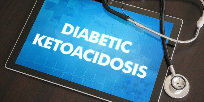 diabetic ketoacidosis