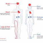Why is it important to manage my blood glucose?