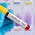 How do you know if you have kidney disease?