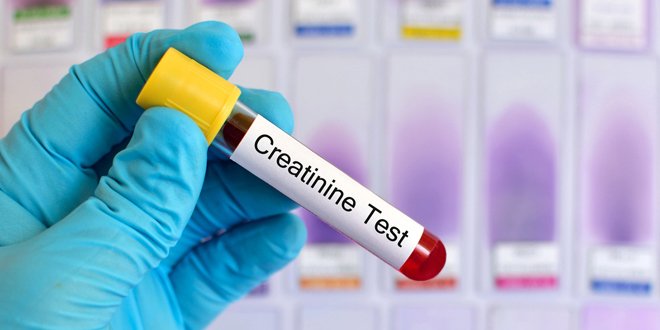 creatinine test
