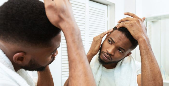 hair loss