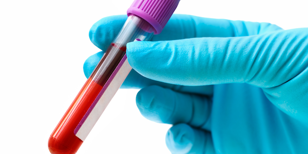 Blood test Blood test