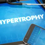 Understanding lipohypertrophy: how to avoid injection site bumps