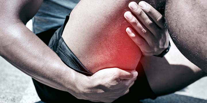 Current recommendations for managing exercise injuries