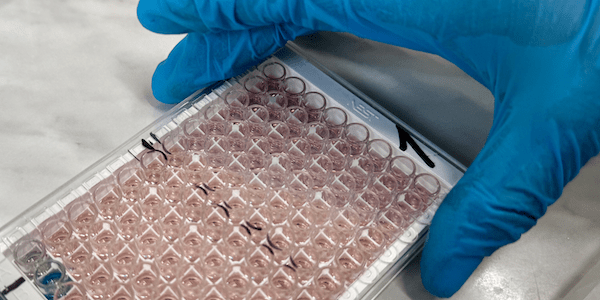 Insulin immunoassay Insulin immunoassay