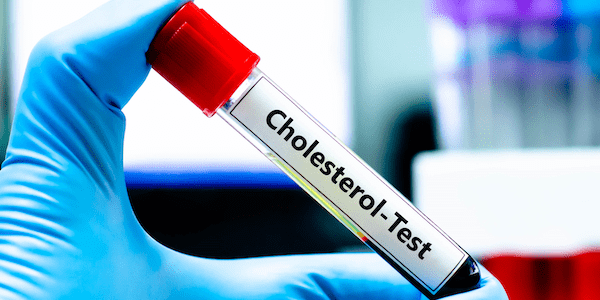 Cholesterol test