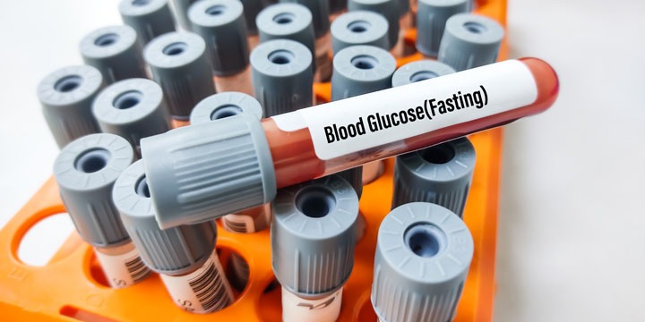 How do you know when to screen for prediabetes?